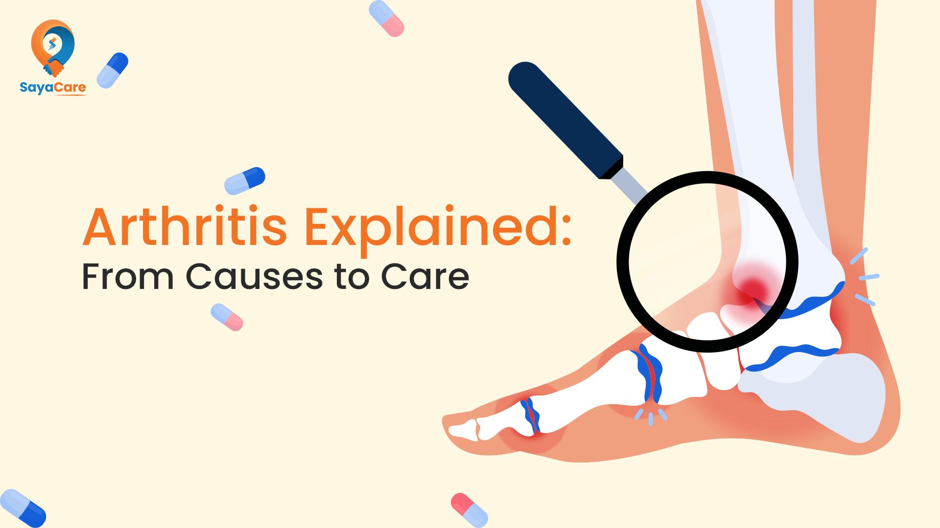understanding-arthritis-what-you-should-know